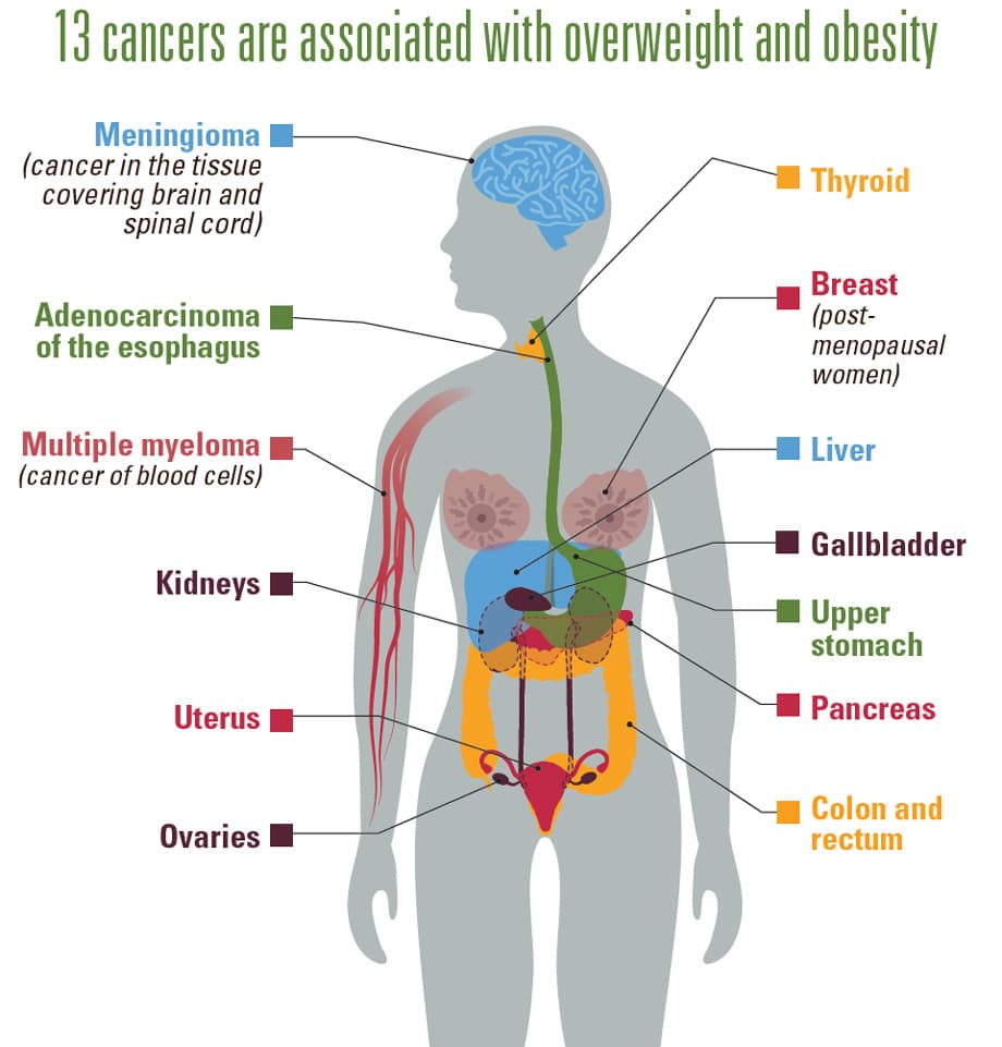 the Connection Between Obesity and Cancer