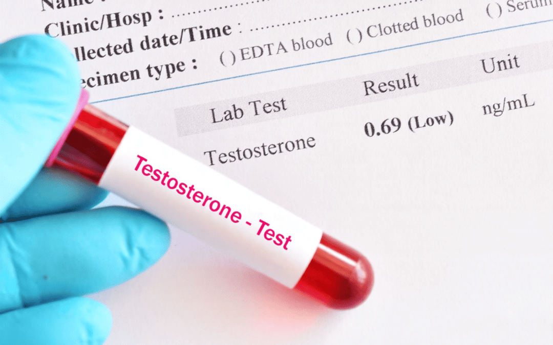 Low Testosterone Symptoms Are Only the Starting Point — Here’s How Diagnosis Really Works