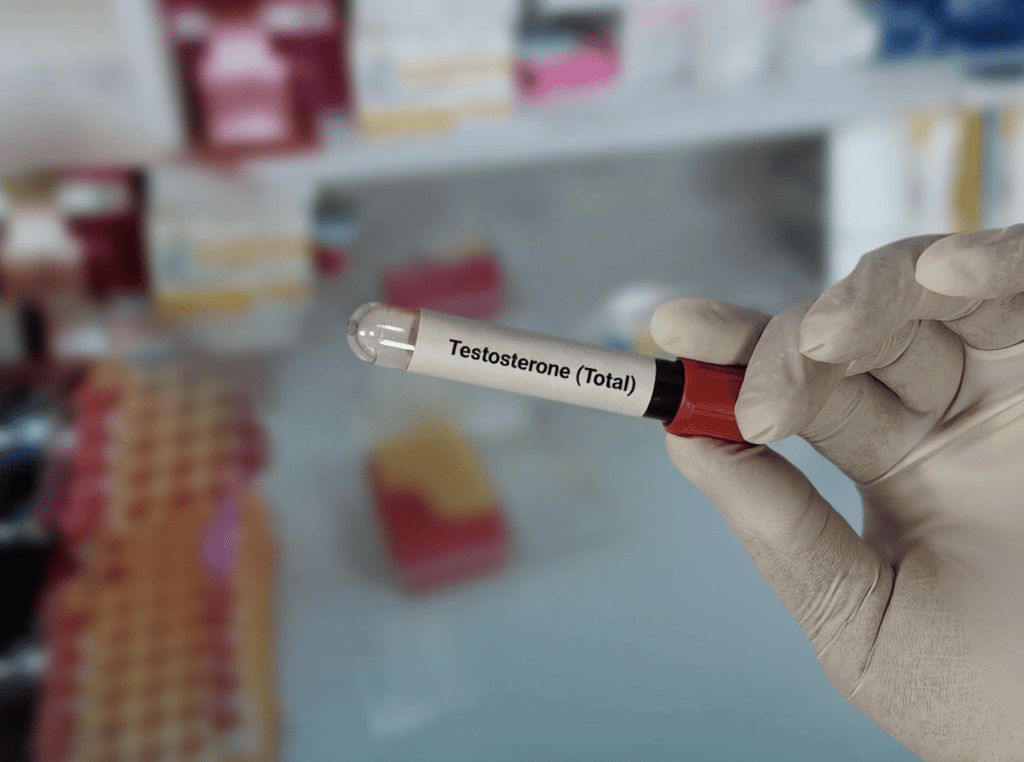 Total testosterone is one of the key markers that needs to be evaluated when treating low testosterone.